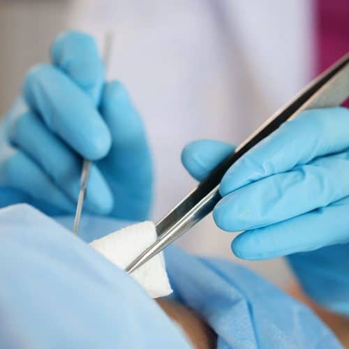 Minor Surgical Operations