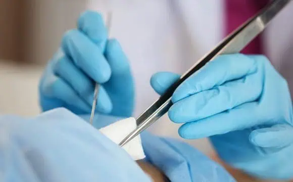 Minor Surgical Operations