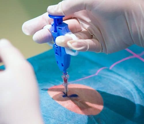 biopsy close up
