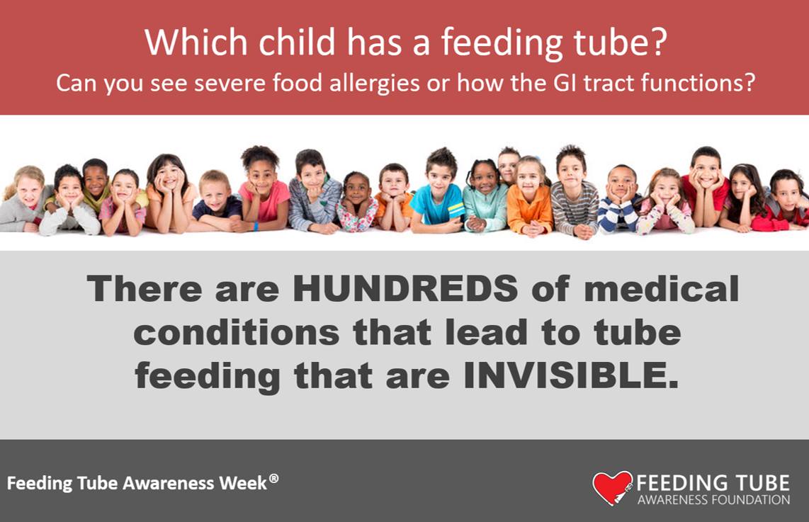 Feeding Tube Awareness Week